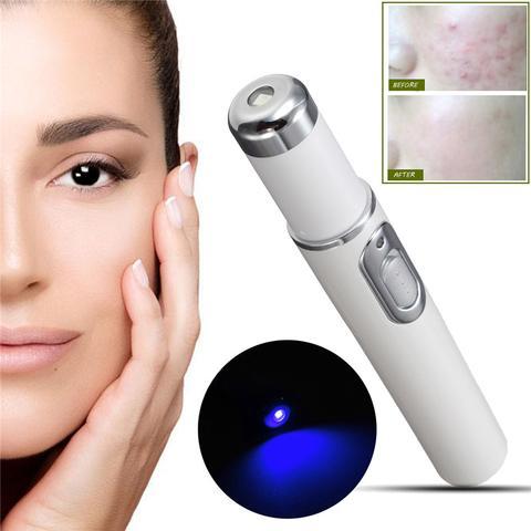 Blue Light Therapy Acne Pen for Soft Scar and Wrinkle Removal - Skin Care Beauty Device
