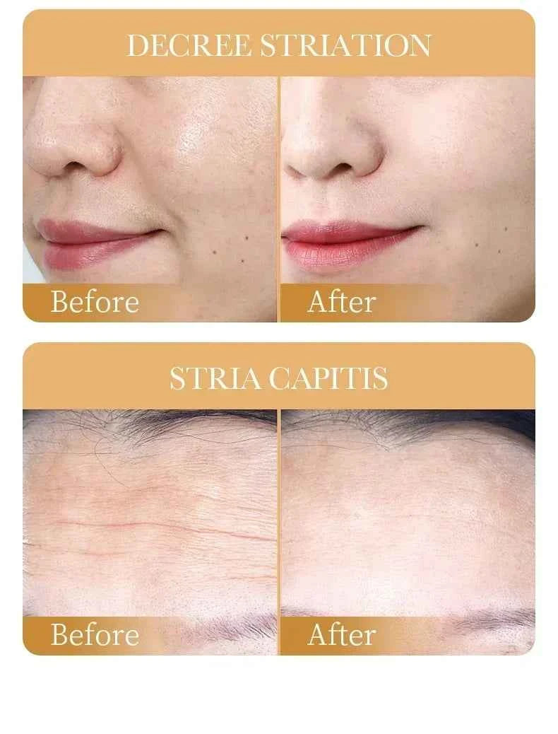 Collagen Anti-Aging Face Mask for Youthful and Radiant Skin