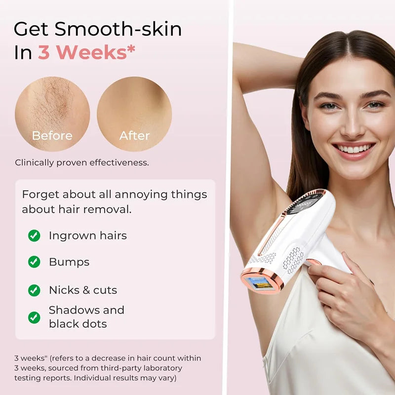 IPL Depilators Permanent Laser Hair Removal Bikini Women's - Allurra Store