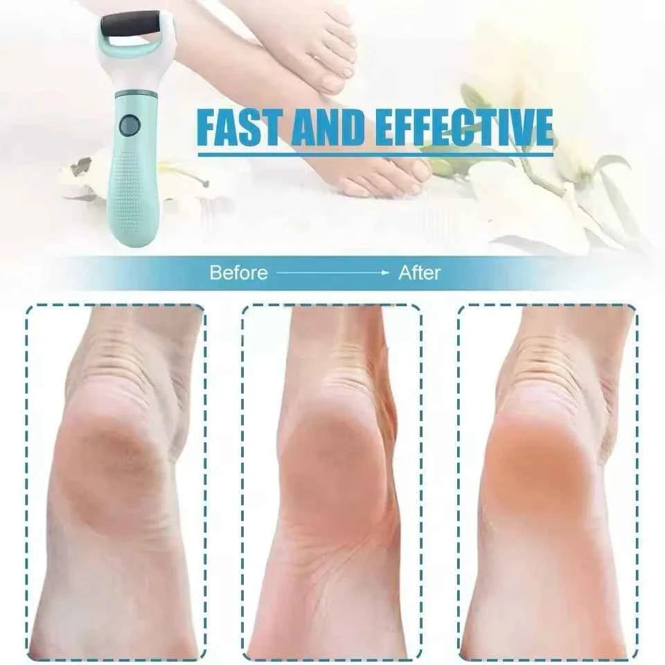 Electric Foot Callus Remover