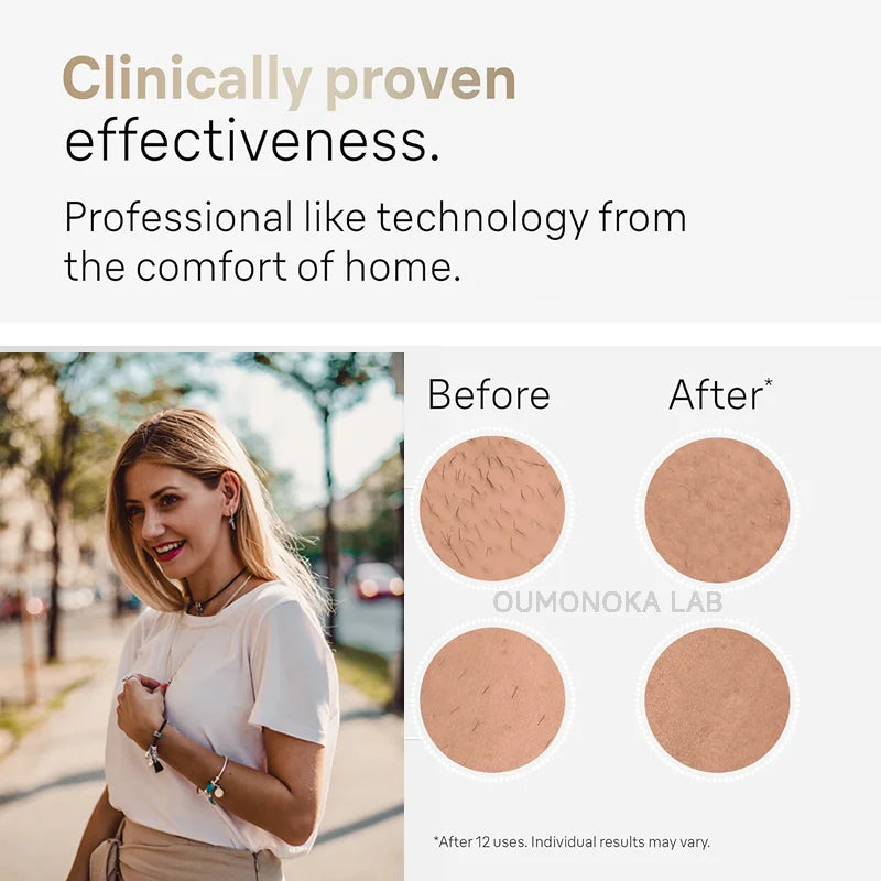 Laser Epilator for Women 999999 Flashes - Allurra Store