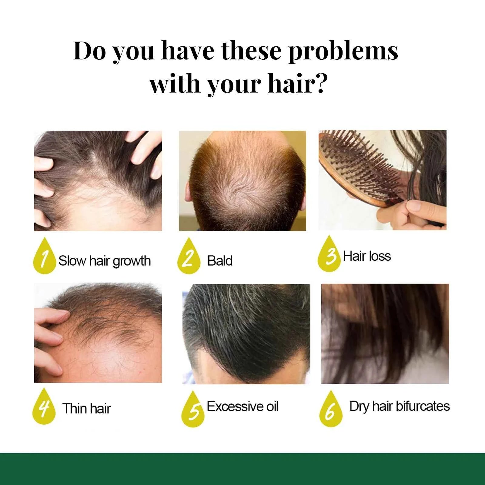 Ginger Hair Growth Spray for Stronger, Thicker Hair